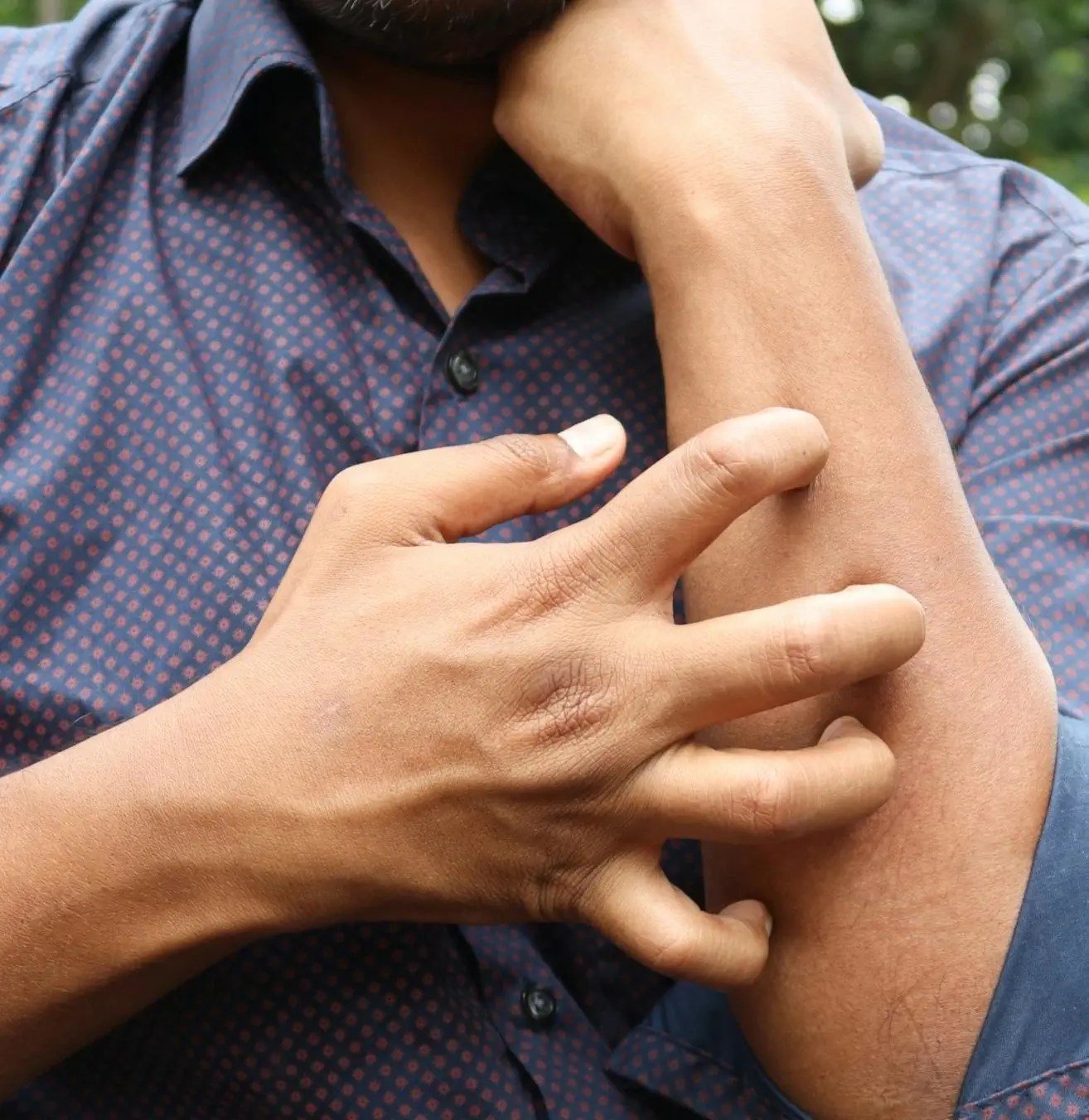 Closeup of man scratching his arm